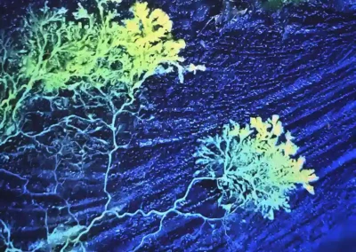 Physarum polycephalum
